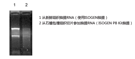 石蜡包埋组织切片RNA提取试剂盒