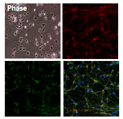 人iPS细胞来源的谷氨酸能神经元祖细胞