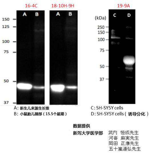 神经生长相关蛋白GAP43单克隆抗体