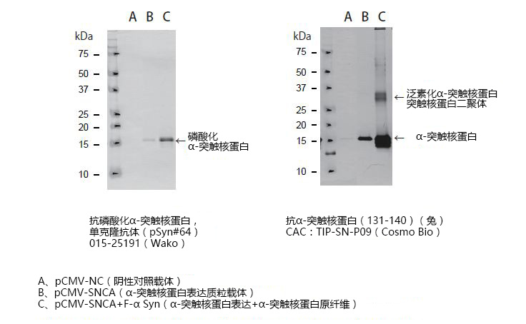 α-突触核蛋白聚集检测试剂盒