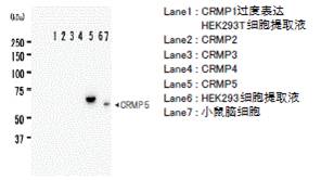 抗CRMP5，单克隆抗体（KZ19）