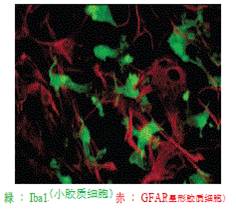 小胶质细胞/巨噬细胞特异性蛋白抗体--Iba1抗体，兔（免疫组化）