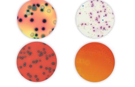 RAPID&#039;Salmonella Agar | Bio-Rad Laboratories