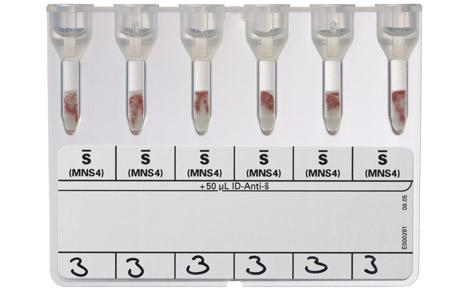 ID-Card s | Bio-Rad Laboratories