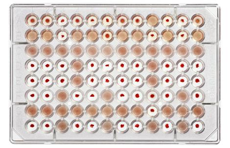 DiaMed-MP 测试 A、B、AB、DVI-、DVI+、Ctl/A1、B | Bio-Rad Laboratories