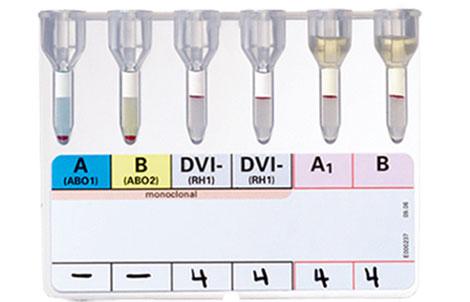 DiaClon ABO/D + Reverse Grouping | Bio-Rad Laboratories