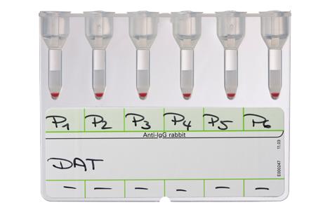 Coombs 抗 IgG | Bio-Rad Laboratories