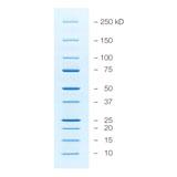 Criterion™ TGX™ Precast Gels | Bio-Rad Laboratories