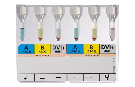 用于捐赠者的 DiaClon ABD 确认 | Bio-Rad Laboratories