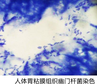 幽门螺旋杆菌染色液,Helicobacter pylori HP