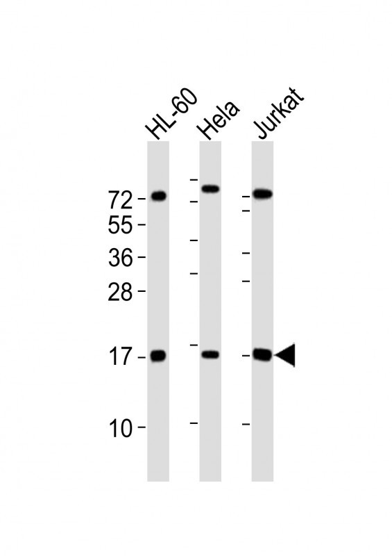 Mouse anti-SUMO1 Monoclonal Antibody(66AT1273.94)