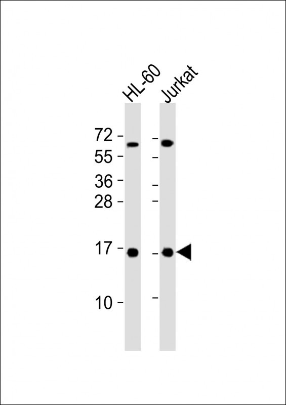 Mouse anti-SUMO1 Monoclonal Antibody(66AT1273.94)
