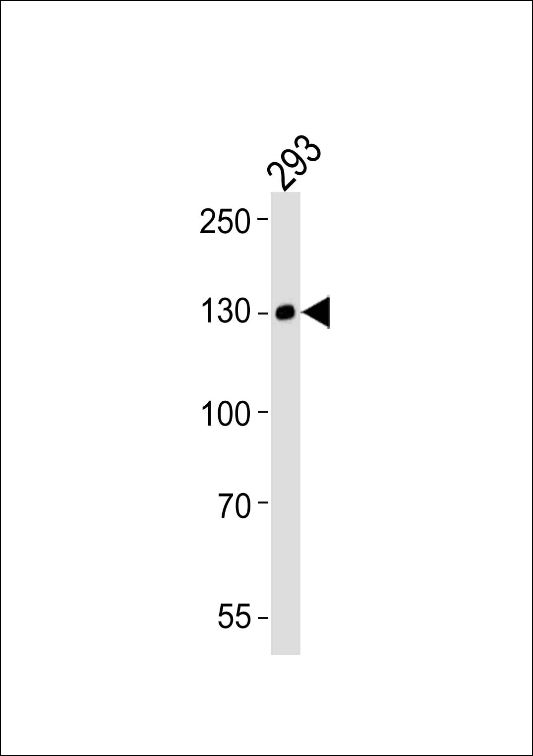 Mouse anti-EPHA6 Monoclonal Antibody(1426CT591.205.91.119)