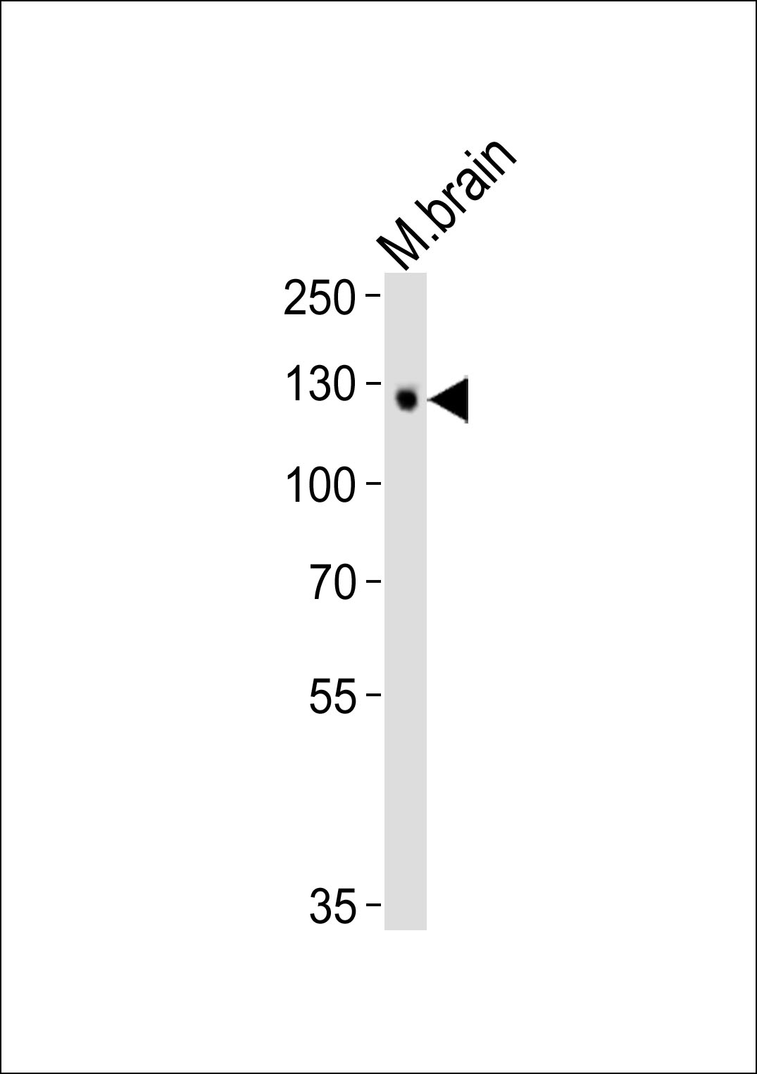 Mouse anti-Tyro3 Monoclonal Antibody(1444CT895.86.31)