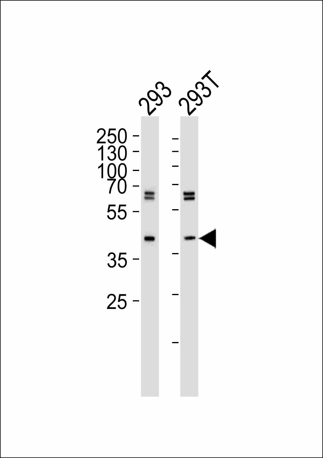 Mouse anti-SET07 Monoclonal Antibody(43AT551.86)