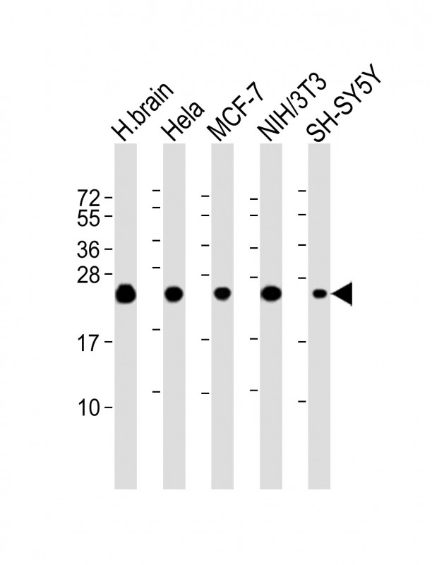 Mouse anti-SODM Monoclonal Antibody(1559CT572.3.83)