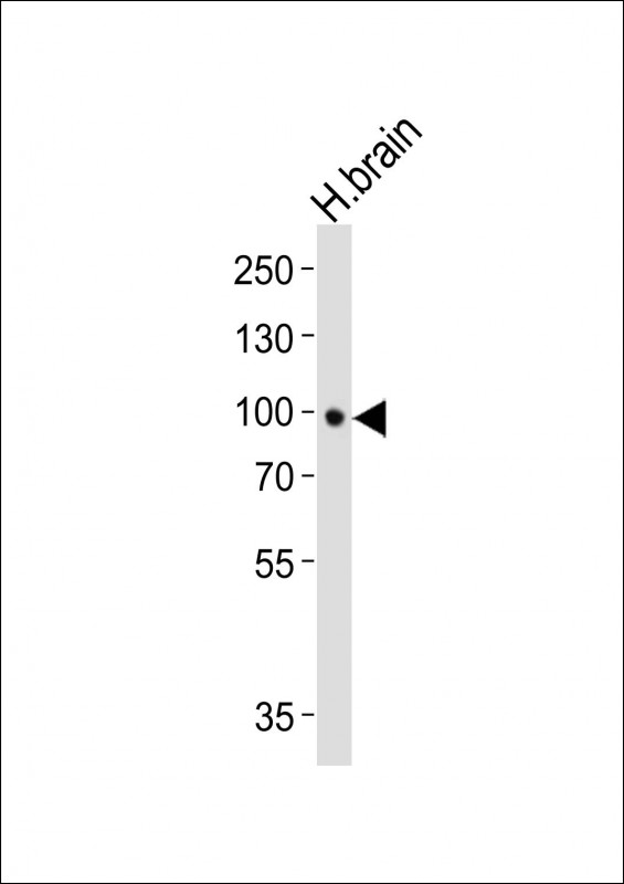 Mouse anti-NTRK2 Monoclonal Antibody(1446CT494.85.83.49)