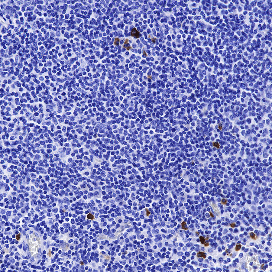 Rabbit anti-Human IgG2  F(c) Recombinant Monoclonal Antibody(318-75)