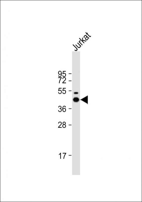 Mouse anti-LCK Monoclonal Antibody(1526CT823.75.16)