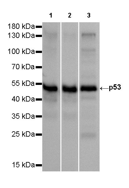 Rabbit anti-p53 Recombinant Monoclonal Antibody(100-72)