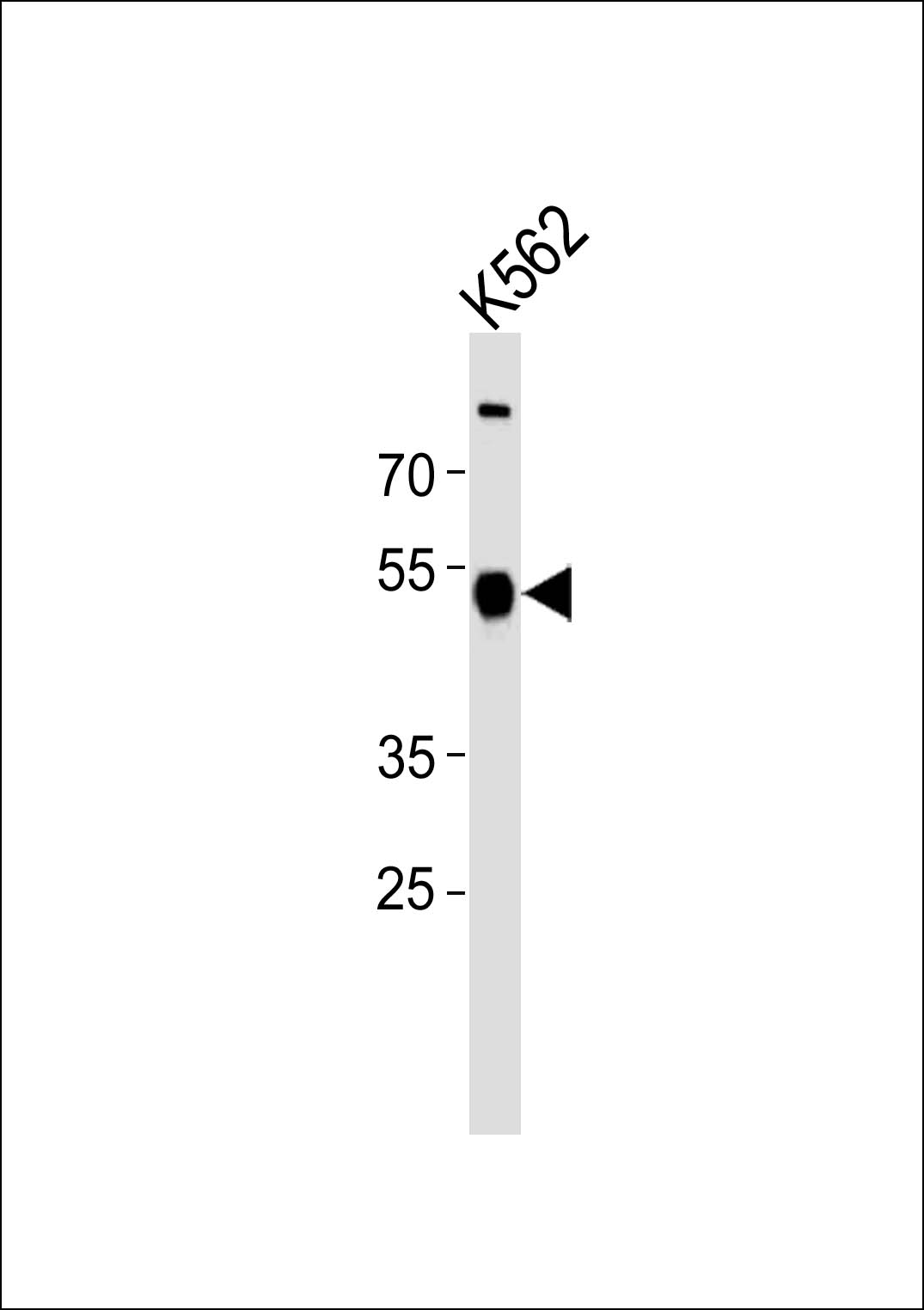 Rabbit anti-ZNF500 Polyclonal Antibody(N-term)