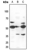 Rabbit anti-ZNF498 Polyclonal Antibody