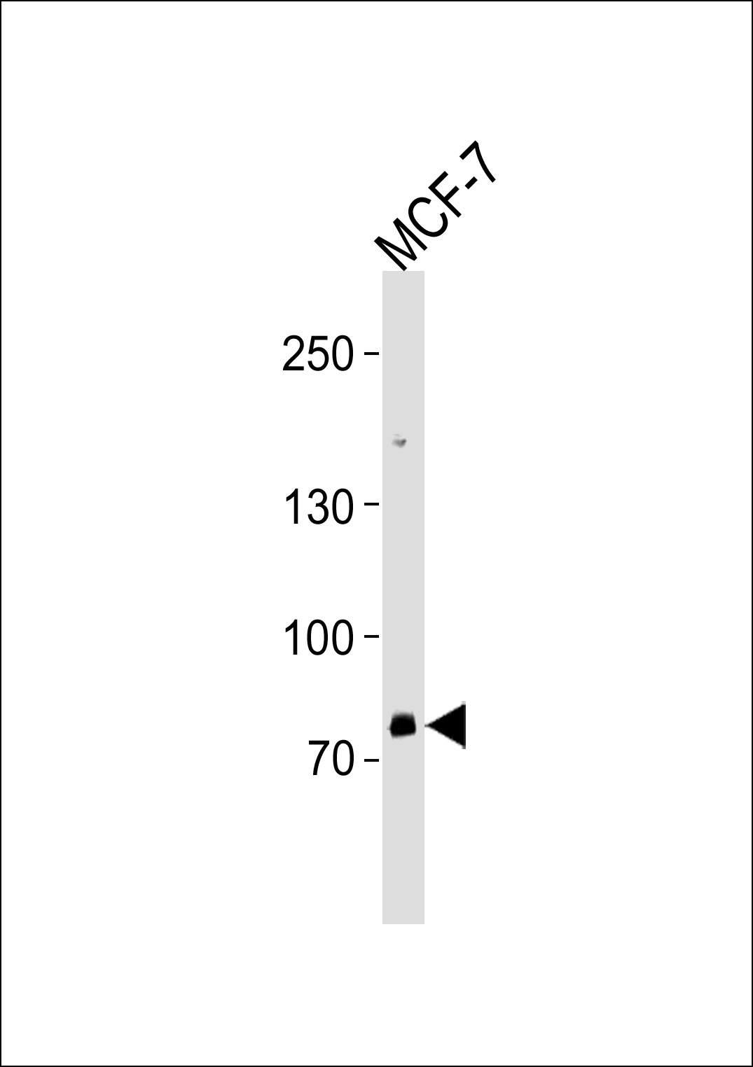 Rabbit anti-ZNF483 Polyclonal Antibody(Center)