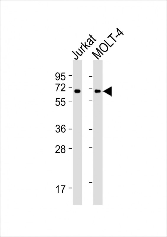 Mouse anti-ZAP70 Monoclonal Antibody(1475CT217.34.65)