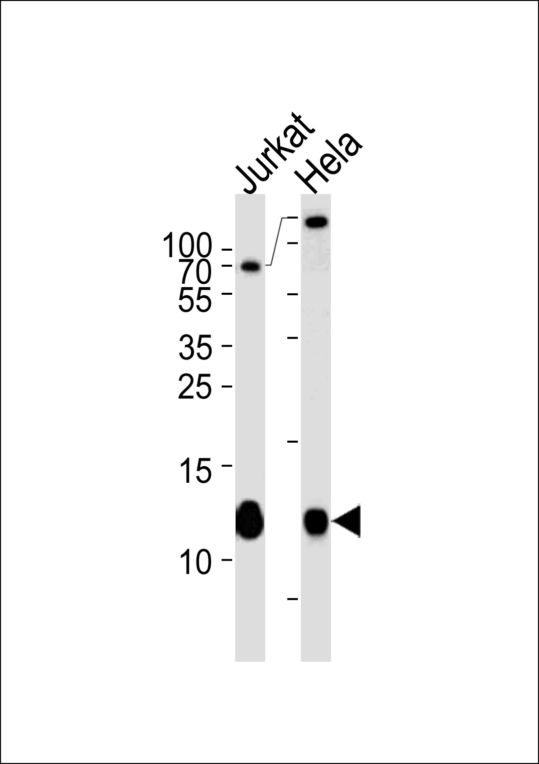 Mouse anti-B2M Monoclonal Antibody(467CT12.3.1)