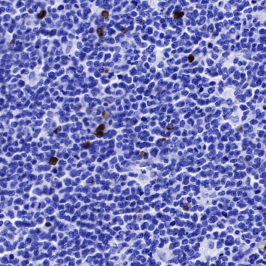 Mouse anti-Human IgG3  F(c) Monoclonal Antibody(S-460-1)