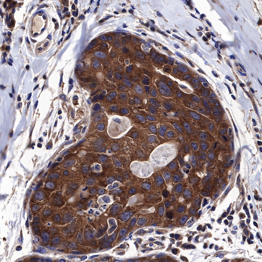Rabbit anti-Atg5 Recombinant Monoclonal Antibody(456-9)