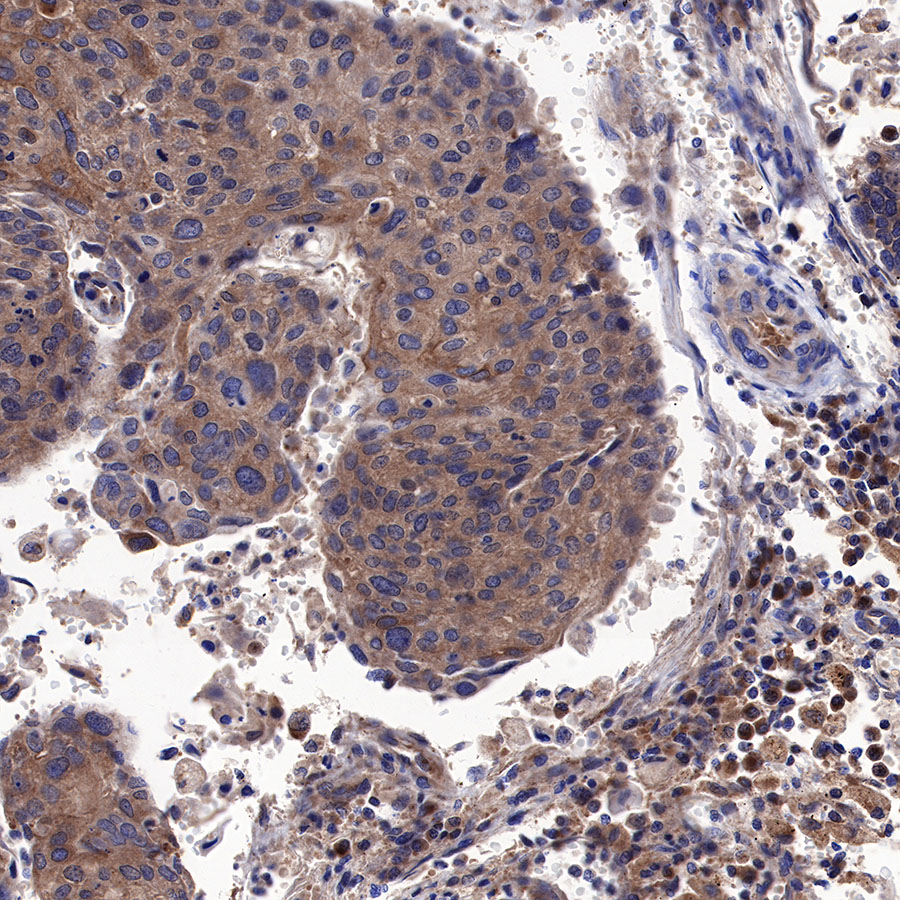 Rabbit anti-Atg5 Recombinant Monoclonal Antibody(456-9)