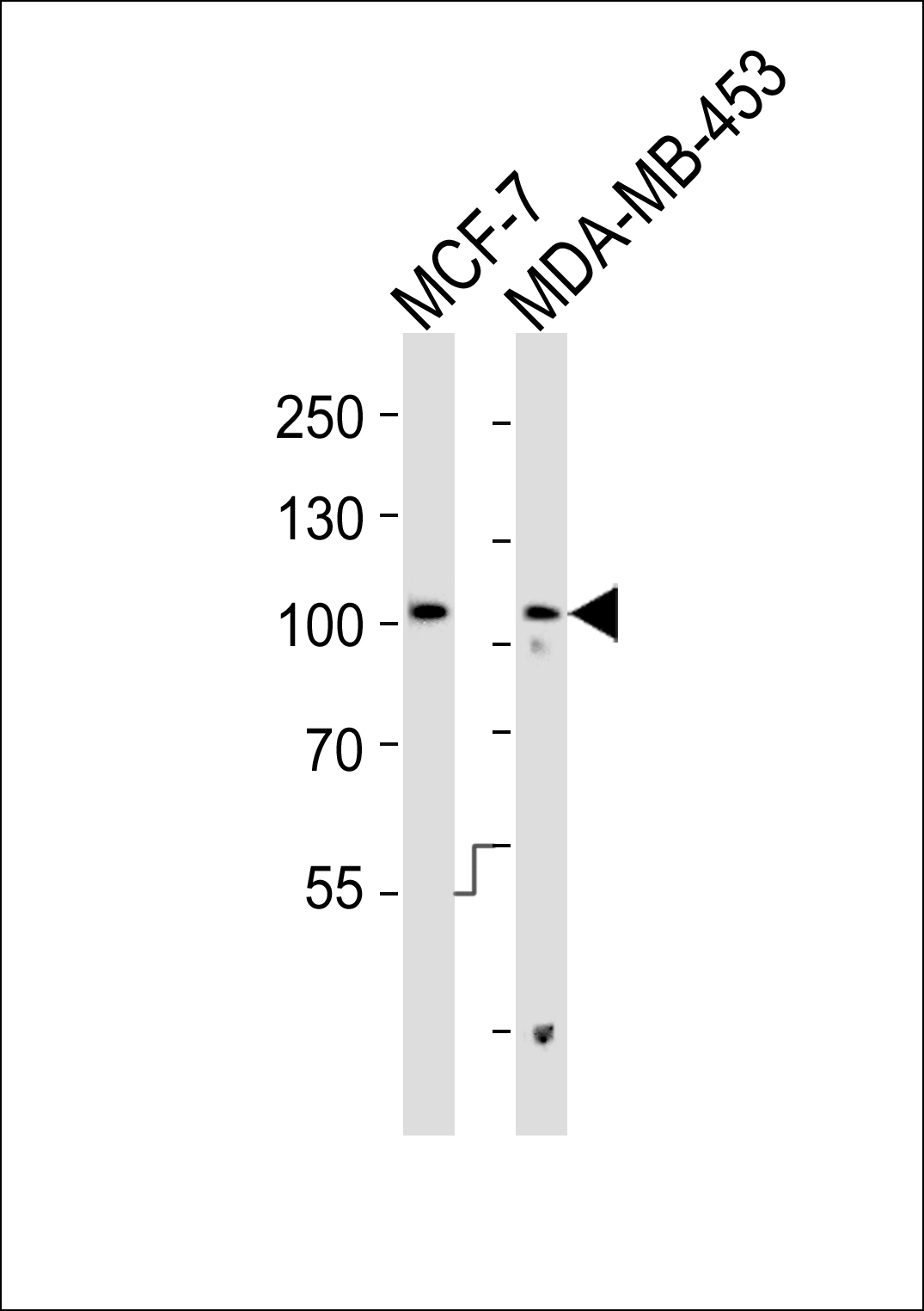 Rabbit anti-AFAP1-Y451 Polyclonal Antibody