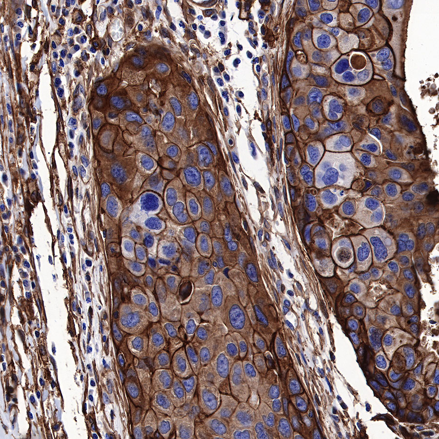 Rabbit anti-Annexin A2 Recombinant Monoclonal Antibody(444-67)