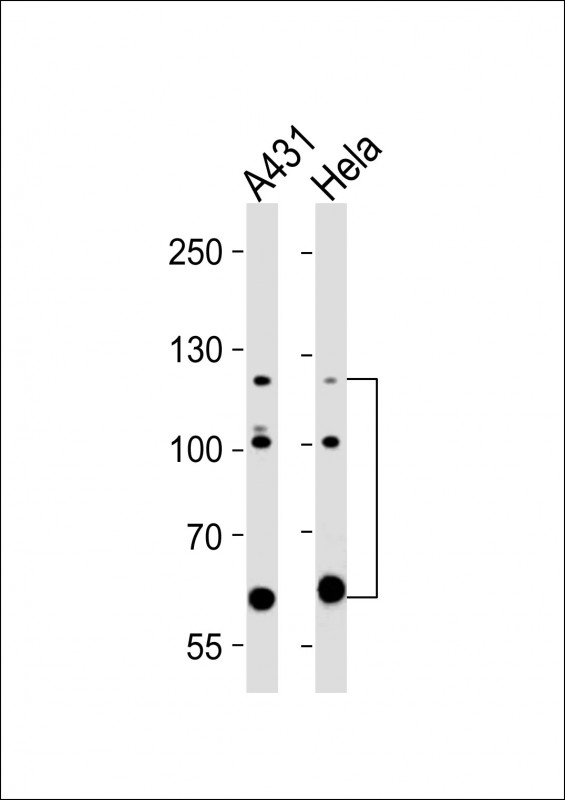 Mouse anti-ABL2 Monoclonal Antibody(1442CT175.30.33)