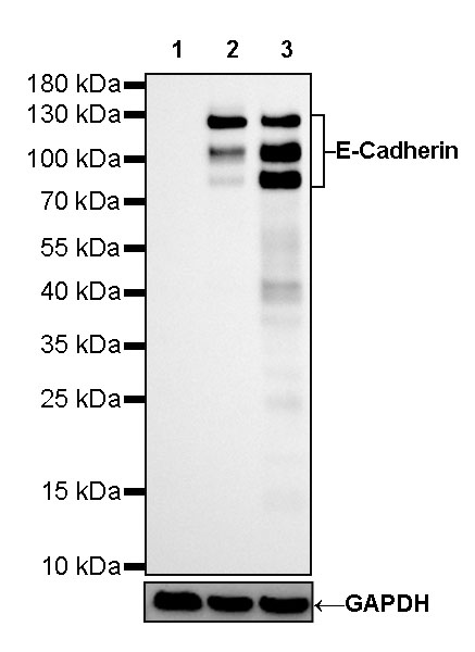 Rabbit anti-E-Cadherin Recombinant Monoclonal Antibody(438-5)