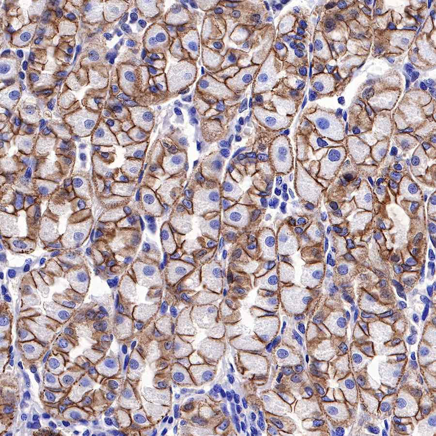 Rabbit anti-E-Cadherin Recombinant Monoclonal Antibody(438-5)