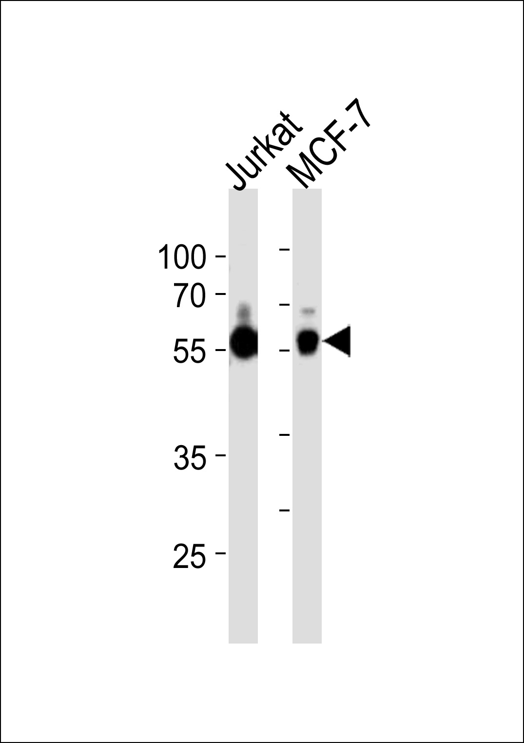 Rabbit anti-ZNF434 Polyclonal Antibody(Center)