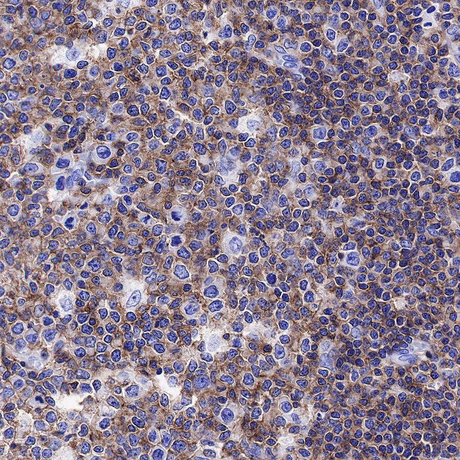 Mouse anti-CD45 Monoclonal Antibody(429-1)
