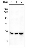 Rabbit anti-SGK1(pS422) Polyclonal Antibody