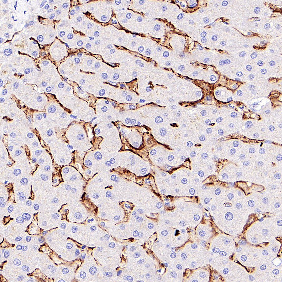 Mouse anti-CD14 Monoclonal Antibody(411-1)