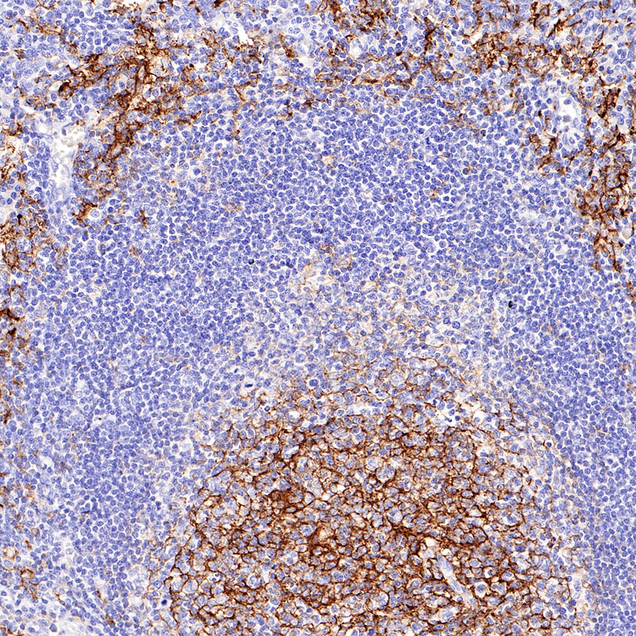Mouse anti-CD14 Monoclonal Antibody(411-1)