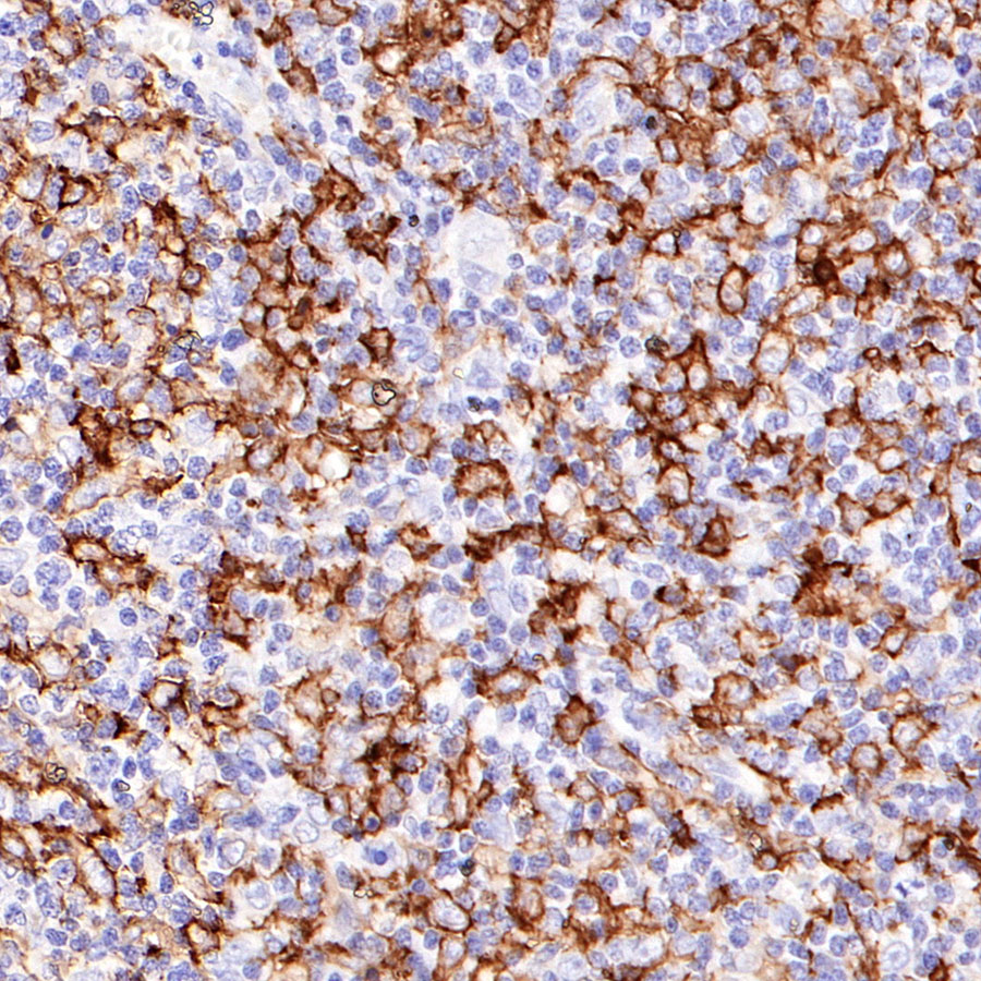 Mouse anti-CD14 Monoclonal Antibody(411-1)