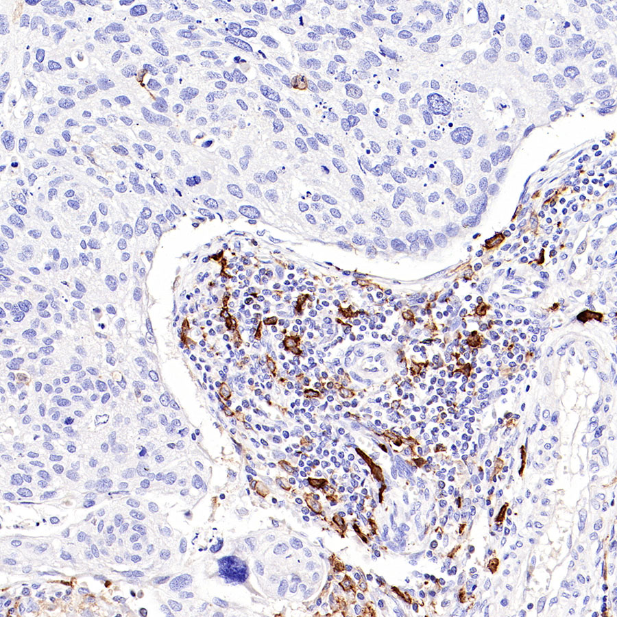Mouse anti-CD14 Monoclonal Antibody(411-1)