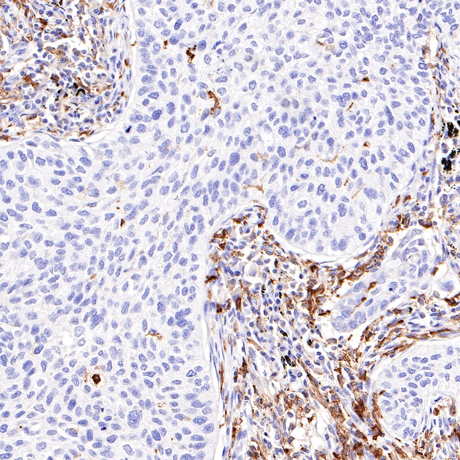 Mouse anti-CD14 Monoclonal Antibody(411-1)
