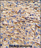 Rabbit anti-Nestin Polyclonal Antibody(S1409)