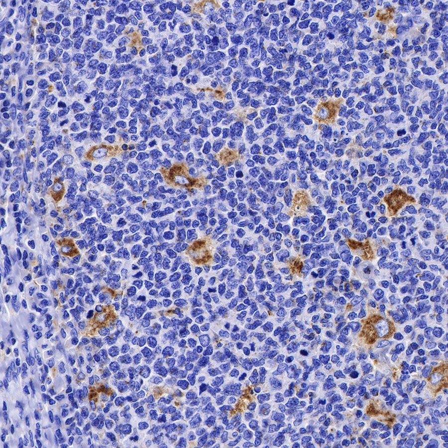 Rabbit anti-LAMP1 Recombinant Monoclonal Antibody(405-39)