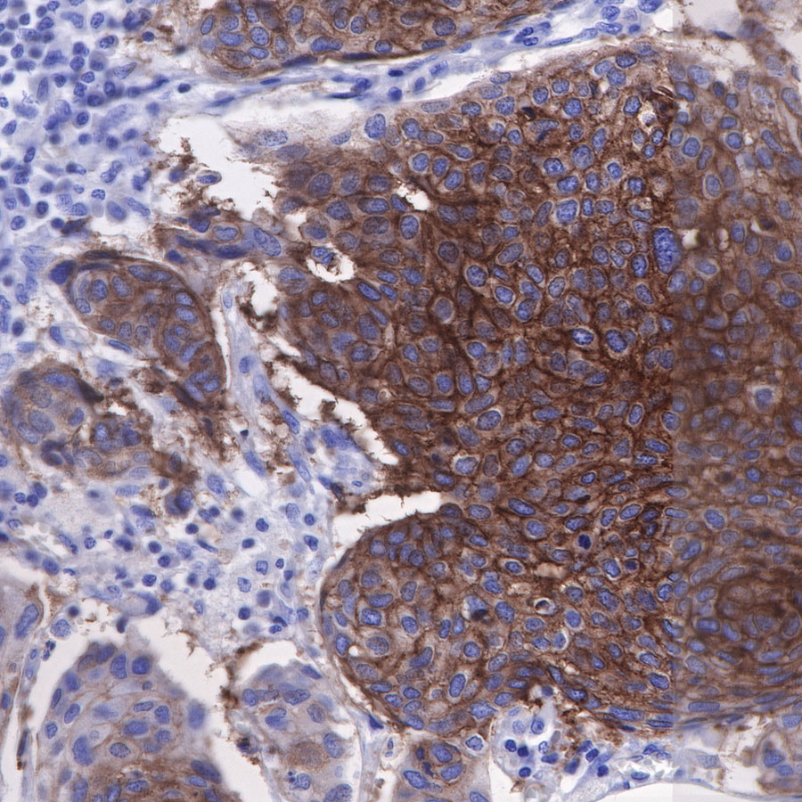 Rabbit anti-CD49b Recombinant Monoclonal Antibody(399-52)