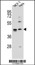 Rabbit anti-ZNF384 Polyclonal Antibody(C-term)