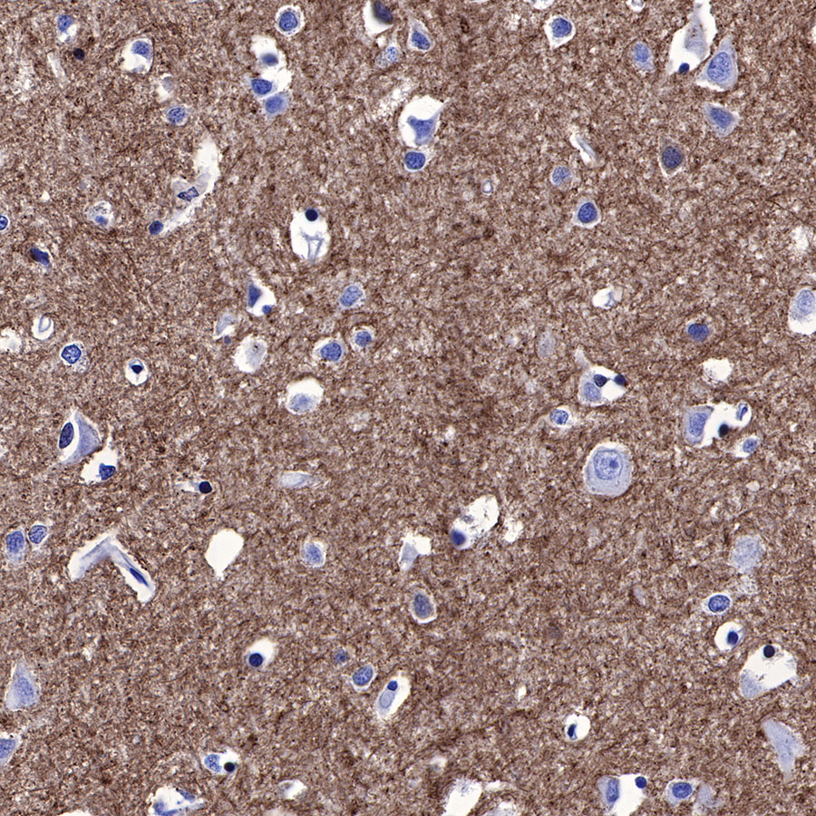 Rabbit anti-Stathmin 1 Recombinant Monoclonal Antibody(383-4)